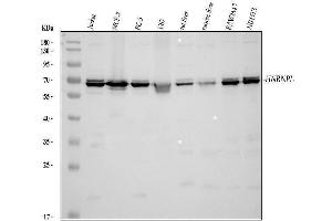 Western blot analysis of HNRNPL using anti-HNRNPL antibody (ABIN4886624). (HNRNPL antibody  (C-Term))