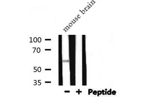 Western blot analysis of ALPL expression in Mouse brain lysate (ALPL antibody  (Internal Region))