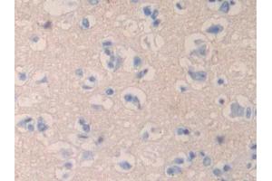 Used in DAB staining on fromalin fixed paraffin- embedded liver tissue (QSOX1 antibody  (AA 37-181))