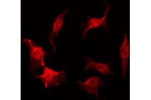 ABIN6269087 staining HeLa by IF/ICC. (HSP27 antibody  (Internal Region))