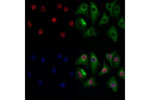 ABIN7093889 and ABIN7097932 staining Hela cells by IF/ICC. (GSTO2 antibody  (N-Term))