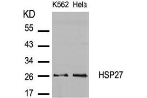 Image no. 2 for anti-Heat Shock 27kDa Protein 1 (HSPB1) (AA 80-84) antibody (ABIN197490) (HSP27 antibody  (AA 80-84))
