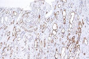 Immunohistochemical staining (Formalin-fixed paraffin-embedded sections) of human kidney tissue using C4A monoclonal antibody, clone C4D204 . (C4A antibody)