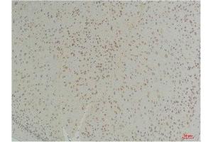 Immunohistochemistry (IHC) analysis of paraffin-embedded Mouse Brain Tissue using Connexin-26Rabbit Polyclonal Antibody diluted at 1:200. (GJB2 antibody)