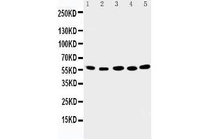 Anti-ABI2 antibody, Western blotting Lane 1: Rat Brain Tissue Lysate Lane 2: Human Placenta Tissue Lysate Lane 3: MCF-7 Cell Lysate Lane 4: HELA Cell Lysate Lane 5: JURKAT Cell Lysate