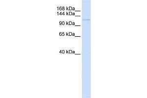 WB Suggested Anti-UBN1 Antibody Titration:  0. (Ubinuclein 1 antibody  (C-Term))