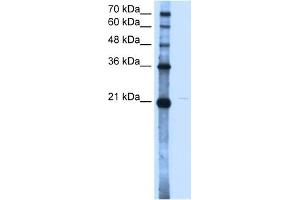 OLR1 antibody used at 2.