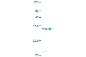 Image no. 1 for Microtubule-Associated Protein 1 Light Chain 3 beta (MAP1LC3B) (AA 1-125) protein (GST tag) (ABIN1310156)