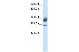 WB Suggested Anti-SIRT5 Antibody Titration:  5. (SIRT5 antibody  (C-Term))