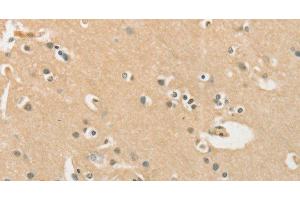 Immunohistochemistry of paraffin-embedded Human brain using CHRNA2 Polyclonal Antibody at dilution of 1:40 (CHRNA2 antibody)