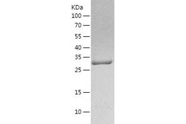 CA1 Protein (AA 1-261) (His tag)