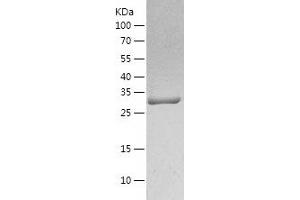 Western Blotting (WB) image for Carbonic Anhydrase I (CA1) (AA 1-261) protein (His tag) (ABIN7122126) (CA1 Protein (AA 1-261) (His tag))