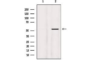 Western Blotting (WB) image for anti-Myocyte Enhancer Factor 2A (MEF2A) (pThr319) antibody (ABIN6255667)