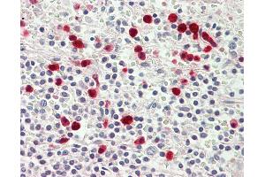 Anti-MYO1E / Myosin IE antibody IHC staining of human spleen. (MYO1E antibody  (AA 228-257))