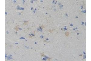 Detection of WARS in Human Cerebrum Tissue using Polyclonal Antibody to Tryptophanyl tRNA Synthetase (WARS) (WARS antibody  (AA 247-458))