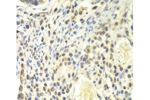 Immunohistochemistry of paraffin-embedded Human colon using PSMA4 Polyclonal Antibody at dilution of 1:100 (40x lens). (PSMA4 antibody)
