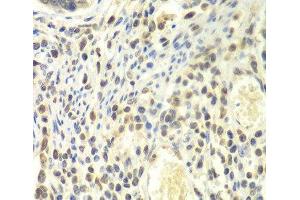 Immunohistochemistry of paraffin-embedded Human colon using PSMA4 Polyclonal Antibody at dilution of 1:100 (40x lens).