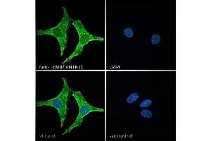 ABIN185280 Immunofluorescence analysis of paraformaldehyde fixed HeLa cells, permeabilized with 0. (ANTXR1 antibody  (C-Term))