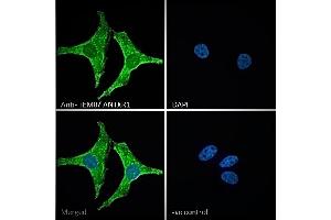 ABIN185280 Immunofluorescence analysis of paraformaldehyde fixed HeLa cells, permeabilized with 0. (ANTXR1 antibody  (C-Term))