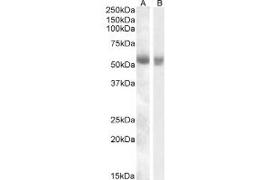 ABIN570926 (0. (TMPRSS2 antibody  (Internal Region))