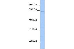 WB Suggested Anti-ZKSCAN4 Antibody Titration:  0.