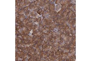 Immunohistochemical staining of human pancreas with EIF4ENIF1 polyclonal antibody  shows strong cytoplasmic positivity in exocrine glandular cells at 1:50-1:200 dilution. (EIF4ENIF1 antibody)