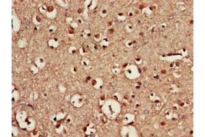 Immunohistochemistry of paraffin-embedded human brain tissue using ABIN7155665 at dilution of 1:100 (CDX4 antibody  (AA 16-174))