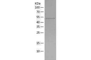 Western Blotting (WB) image for Suppressor of Cytokine Signaling 3 (SOCS3) (AA 1-225) protein (His-IF2DI Tag) (ABIN7125255) (SOCS3 Protein (AA 1-225) (His-IF2DI Tag))