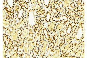 ABIN6275007 at 1/100 staining Mouse kidney tissue by IHC-P. (CLIC4 antibody  (N-Term))