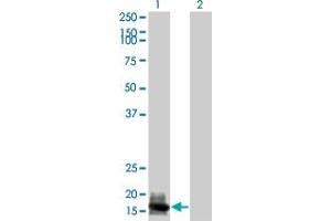 Western Blot analysis of GUCA1A expression in transfected 293T cell line by GUCA1A monoclonal antibody (M04), clone 2F7. (GCAP1 antibody  (AA 1-93))