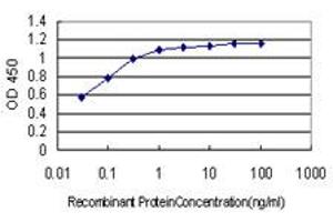 Detection limit for recombinant GST tagged BCL9 is approximately 0. (BCL9 antibody  (AA 1036-1135))