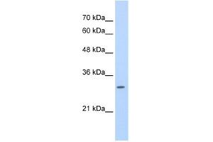 WB Suggested Anti-SLBP Antibody Titration:  0. (SLBP antibody  (Middle Region))