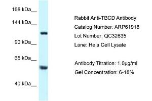 Western Blotting (WB) image for anti-Tubulin Folding Cofactor D (TBCD) (N-Term) antibody (ABIN2788948) (TBCD antibody  (N-Term))