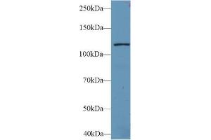 Western blot analysis of Mouse Liver lysate, using Human LARS Antibody (2 µg/ml) and HRP-conjugated Goat Anti-Rabbit antibody ( (LARS antibody  (AA 260-509))