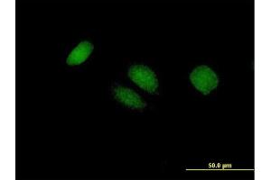Immunofluorescence of purified MaxPab antibody to BTG4 on HeLa cell. (BTG4 antibody  (AA 1-206))