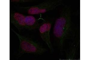 Image no. 1 for anti-H2A Histone Family, Member X (H2AFX) (Ser139) antibody (ABIN197524)