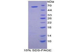 SDS-PAGE (SDS) image for Cathepsin A (CTSA) (AA 234-494) protein (His tag,GST tag) (ABIN2122569)