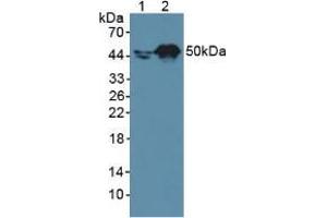Western blot analysis of (1) Human A431 Cells and (2) Human HepG2 Cells. (Retinoic Acid Receptor alpha antibody  (AA 237-459))