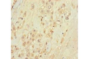 Immunohistochemistry of paraffin-embedded human placenta tissue using ABIN7171488 at dilution of 1:100 (TLN2 antibody  (AA 88-406))