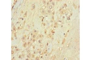 Immunohistochemistry of paraffin-embedded human placenta tissue using ABIN7171488 at dilution of 1:100 (TLN2 antibody  (AA 88-406))