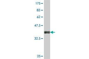 Western Blot detection against Immunogen (37. (CTRB1 antibody  (AA 101-200))