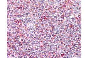 Anti-RELB antibody IHC of human spleen. (RELB antibody  (N-Term))