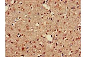 Immunohistochemistry of paraffin-embedded human brain tissue using ABIN7153517 at dilution of 1:100