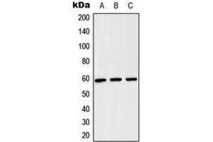 Western blot analysis of TCP1 theta expression in H1299 (A), NIH3T3 (B), PC12 (C) whole cell lysates. (CCT8 antibody  (Center))