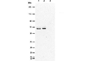 Western Blotting (WB) image for Norovirus GII.4 VP1 protein-VLP (ABIN7538802)