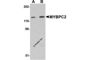 Western Blotting (WB) image for anti-Myosin Binding Protein C, Fast Type (MYBPC2) (C-Term) antibody (ABIN1030525) (MYBPC2 antibody  (C-Term))