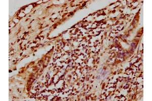 IHC image of nhibHU diluted at 1:8 and staining in paraffin-embedded human lung tissue performed on a Leica BondTM system. (HIST1H4A antibody  (AA 1-12))