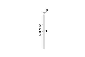 All lanes : Anti-TMEM150B Antibody (N-term) at 1:1000 dilution Lane 1 : Caco2 whole cell lysate Lysates/proteins at 20 μg per lane. (TMEM150B antibody  (N-Term))