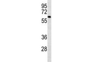 CAMKK2 western blot analysis in mouse cerebellum tissue lysate. (CAMKK2 antibody)