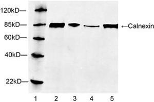 Lane 1: MarkerLane 2: Hela cell lysateLane 3: HEK293 cell lysateLane 4: NIH/3T3 cell lysateLane 5: HepG2 cell lysateWestern blot analysis of cell lysates using 1 µg/mL Rabbit Anti-Calnexin Polyclonal Antibody (ABIN398769) The signal was developed with IRDyeTM 800 Conjugated Goat Anti-Rabbit IgG.
